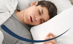 Screening for sleep apnea matters.