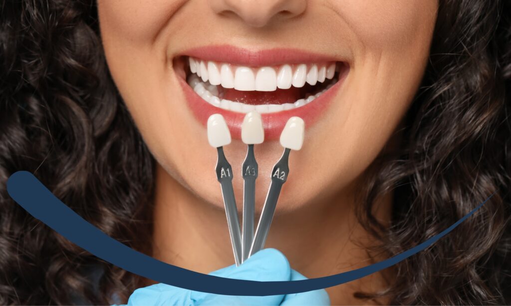 Here's how professional tooth whitening works.