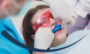 Know the ways to prevent cavities.